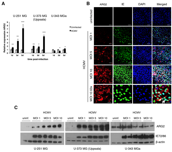 HCMV upregulates ARG2 in glioblastoma cell lines.