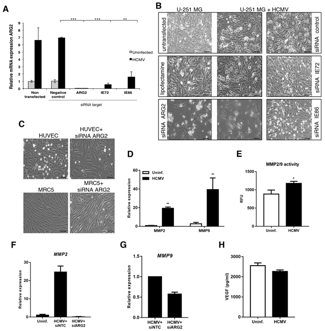 HCMV upregulates ARG2 in glioblastoma cell lines through the expression of IE genes.