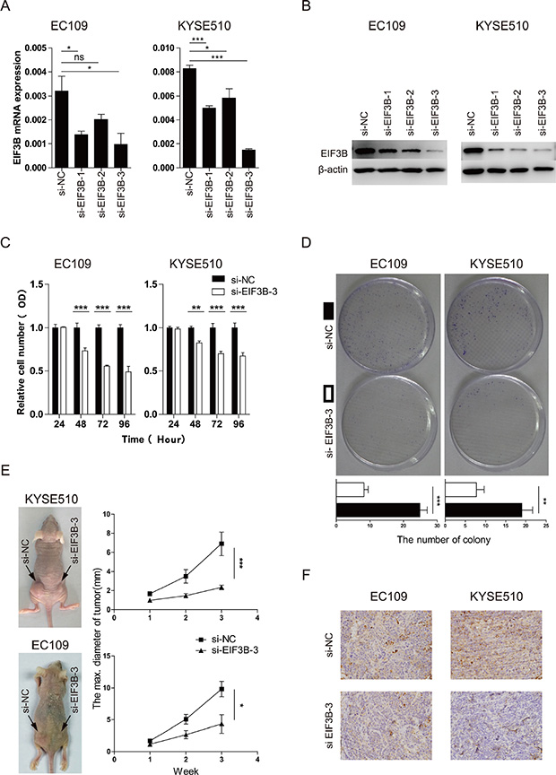 EIF3B promotes the cell proliferation of ESCC.