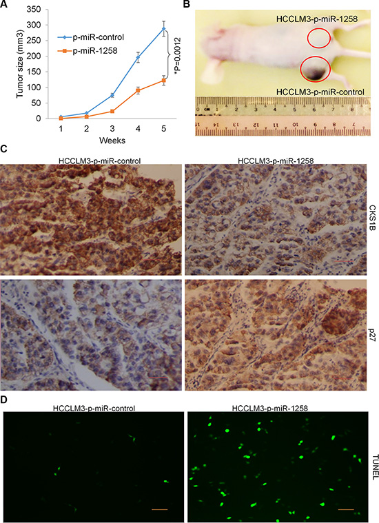 Stable overexpression of miR-1258 decreases tumorigenicity of HCC cells.