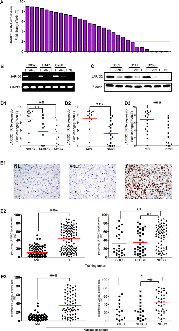 JARID2 is significantly upregulated in HCC tissues.