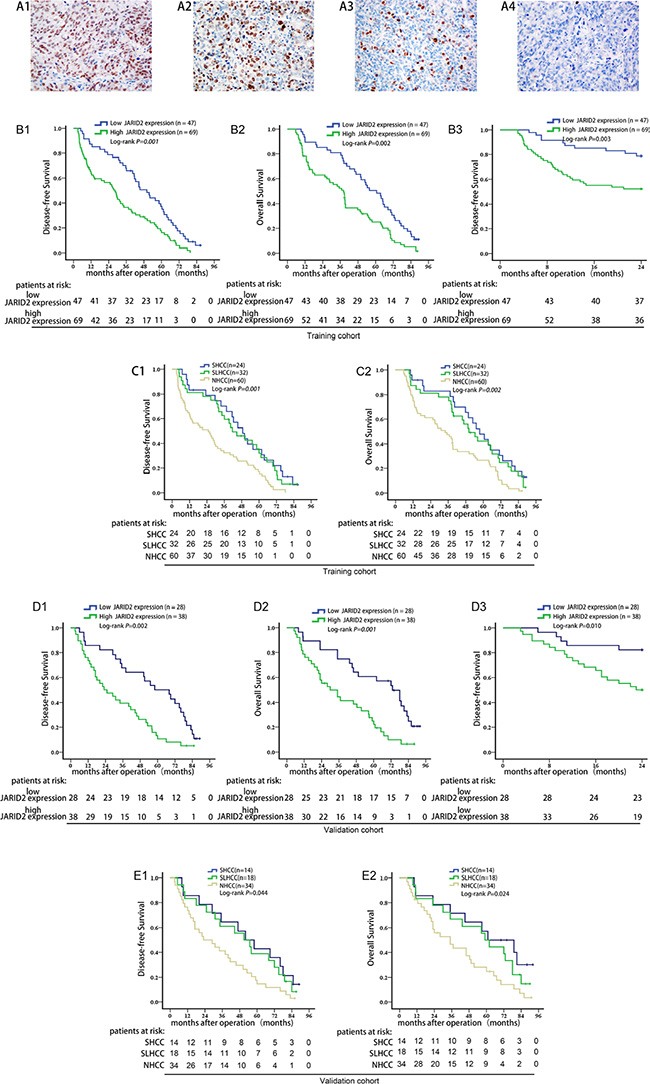 High JARID2 expression is significantly correlated with poor prognosis of HCC.
