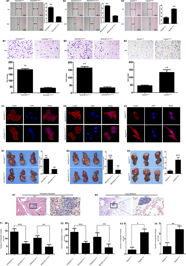 JARID2 significantly promotes invasion and metastasis of HCC cells in vitro and in vivo.