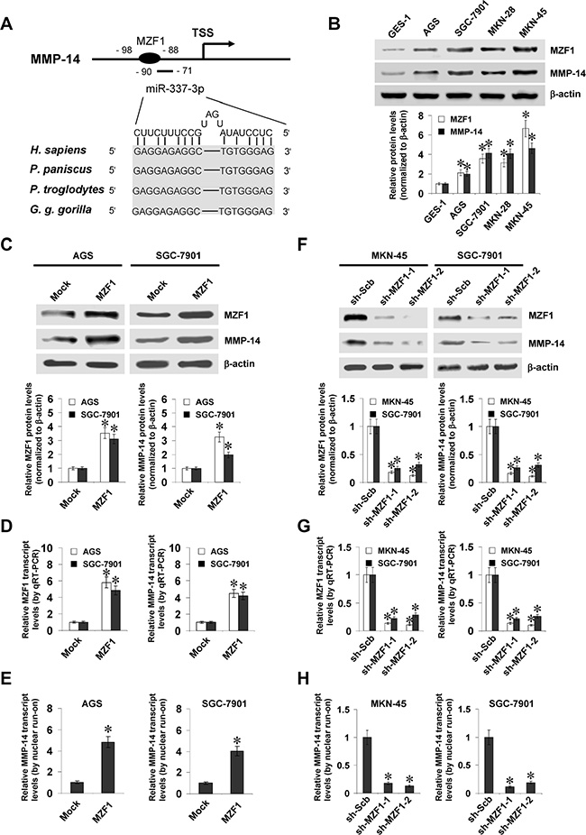 MZF1 facilitates the expression of MMP-14 in gastric cancer cells.