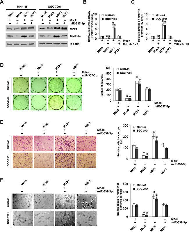 miR-337-3p suppresses the growth, invasion, and angiogenesis of gastric cancer cells through repressing MZF1-facilitated MMP-14 expression in vitro.