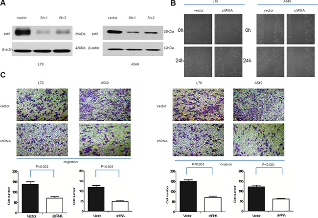 SIRT6 knockdown decreases NSCLC cell migration and invasion.