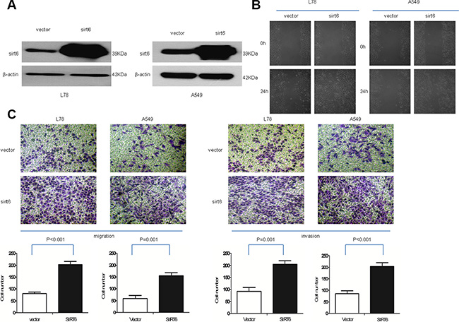 Ectopic SIRT6 expression enhances NSCLC cell migration and invasion.