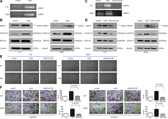 SIRT6 promotes NSCLC cell migration and invasion through ERK1/2//MMP9.