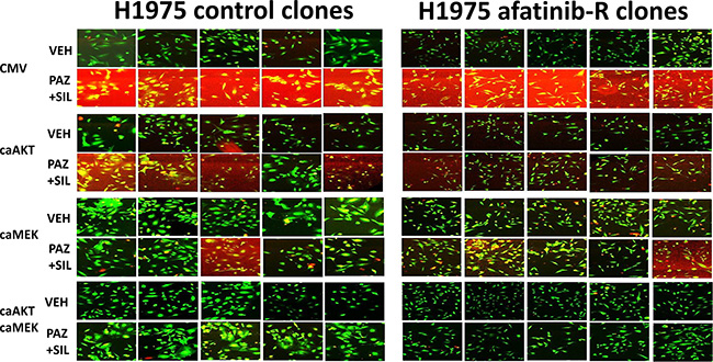 In vivo generated afatinib resistant H1975 clones are killed by [pazopanib + sildenafil] and are protected by dual, but not individual, activation of MEK1 and AKT signaling.