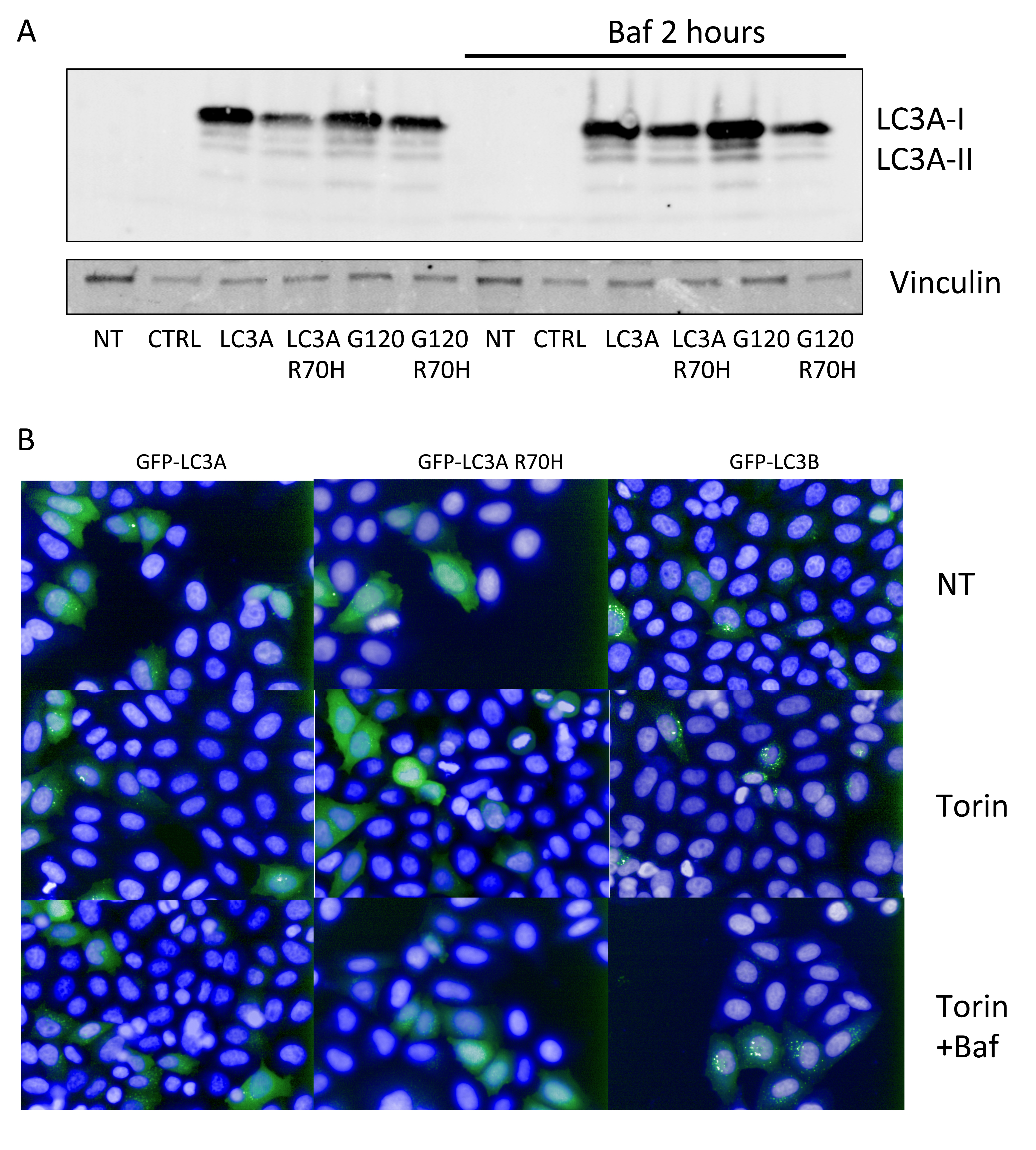 Reduced LC3A R70H processing in cells.