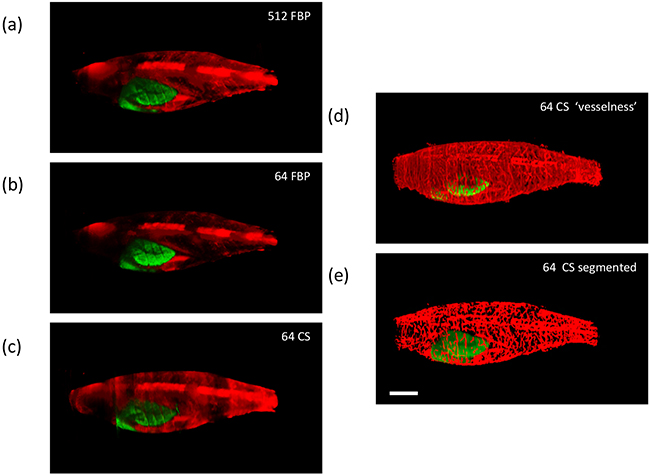 Exemplar reconstructed OPT images of adult [81 days post fertilization (dpf)] TraNac Tg (KDR:m Cherry:Fabp10-rtTA:TRE-eGFPKRASV12) zebrafish expressing liver specific eGFP-labelled tumour and mCherry-labelled vasculature showing maximum intensity projections of eGFP (green) and mCherry (red) fluorescence (scale bar = 2.5 mm).