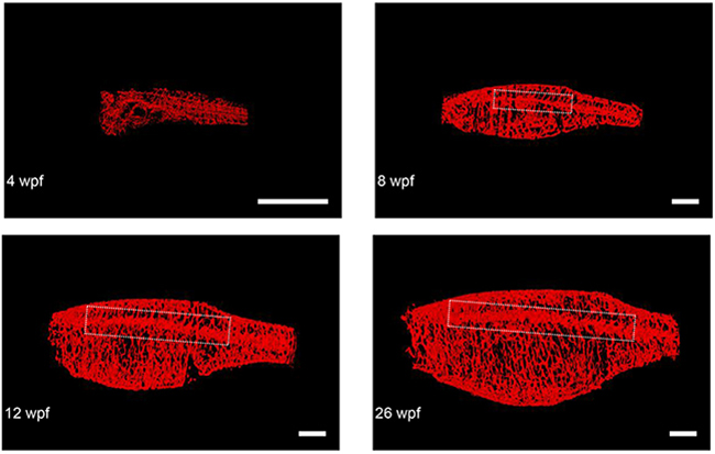 Representative final reconstructed CS-OPT images from a longitudinal study of an individual TraNac Tg (KDR:mCherry) zebrafish re-imaged at 4, 8, 12 and 26 weeks post fertilisation (wpf).