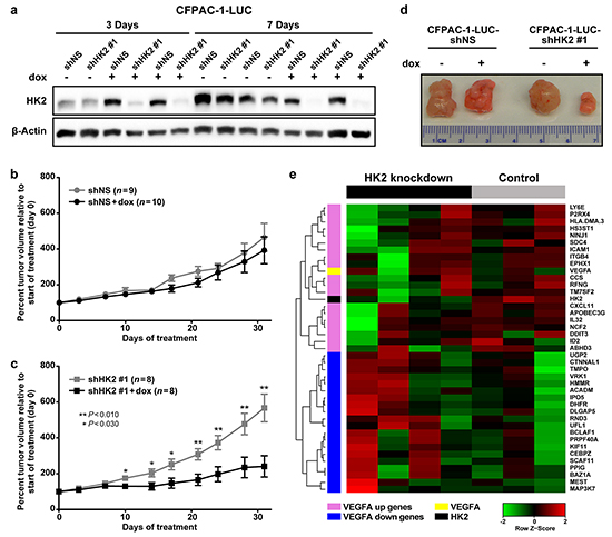 HK2 is required for PDAC primary tumor growth and regulates gene expression.