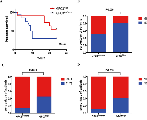Low GPC3 expression correlates with metastasis and poor survival.