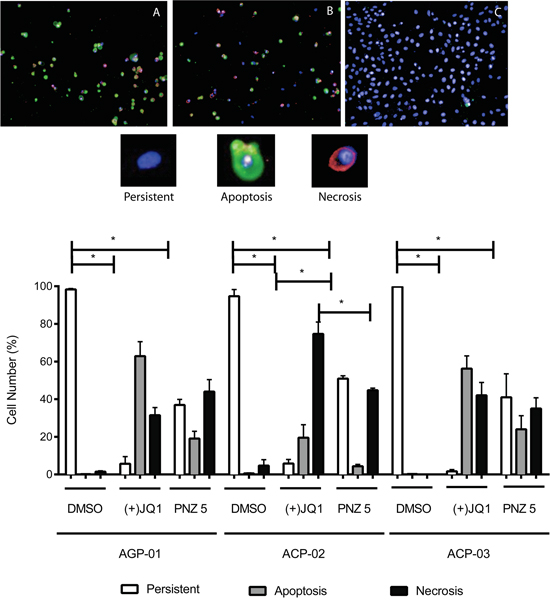 High content images of in vitro cytotoxic activity of (+)-JQ1 A. and PNZ5 B. on cell death pattern in gastric cancer cell lines compared to DMSO control C. (upper panel).