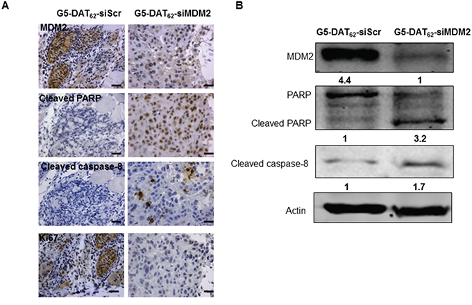 MDM2 knockdown inhibits PC9 tumor growth via promoting apoptosis.
