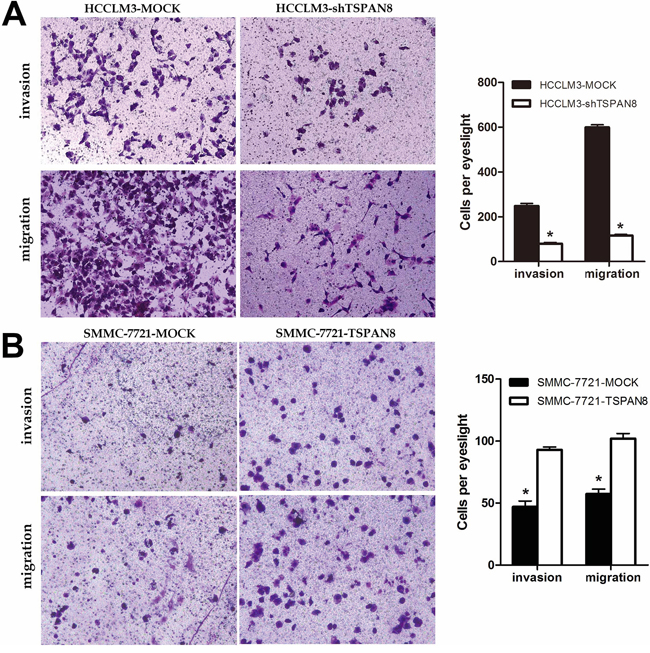 High expression of TSPAN8 promoted HCC metastasis and invasion in vitro.