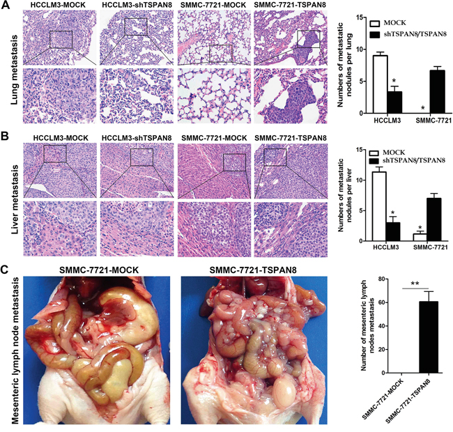 High expression of TSPAN8 promoted HCC metastasis and invasion in vivo.