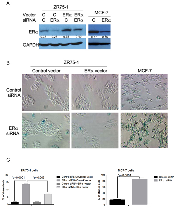 Induction of senescence-like phenotypes by the inhibition of ER&#x3b1; expression in ER&#x3b1; positive breast cancer cells.