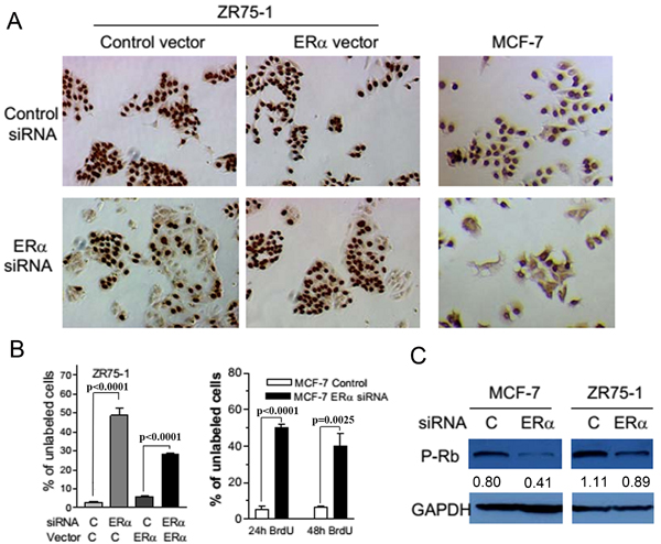 The suppression of ER&#x3b1; expression inhibited DNA synthesis and reduced the phosphorylation of Rb in breast cancer cells.