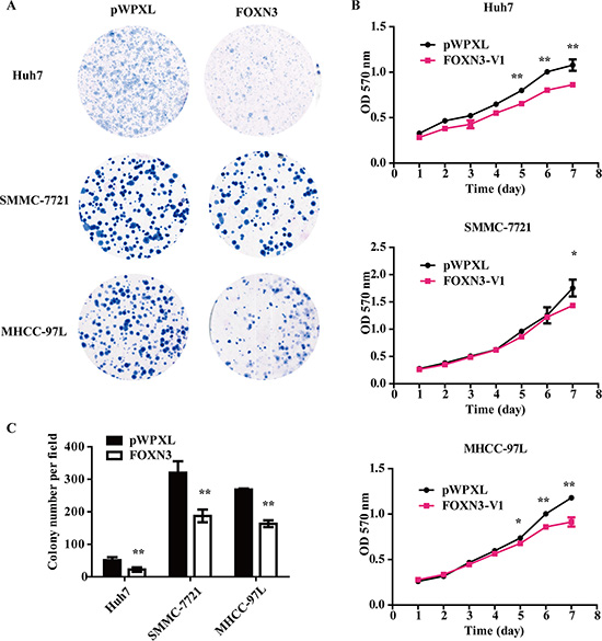 Overexpression of FOXN3 in HCC cells inhibits proliferation in vitro.