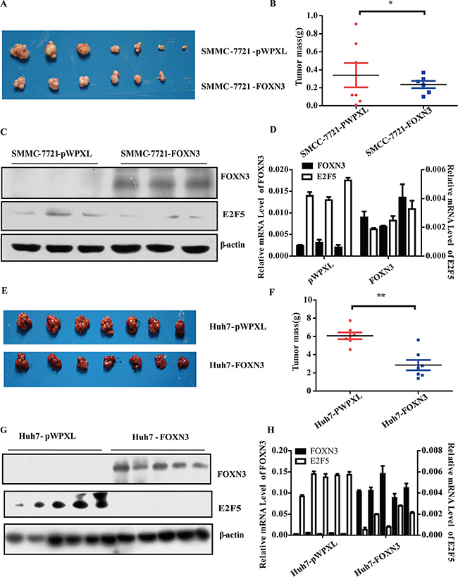 FOXN3 suppresses HCC tumorigenesis in vivo.