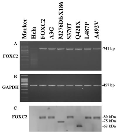 Exogenous FOXC2 expression of mutant recombinant plasmids.