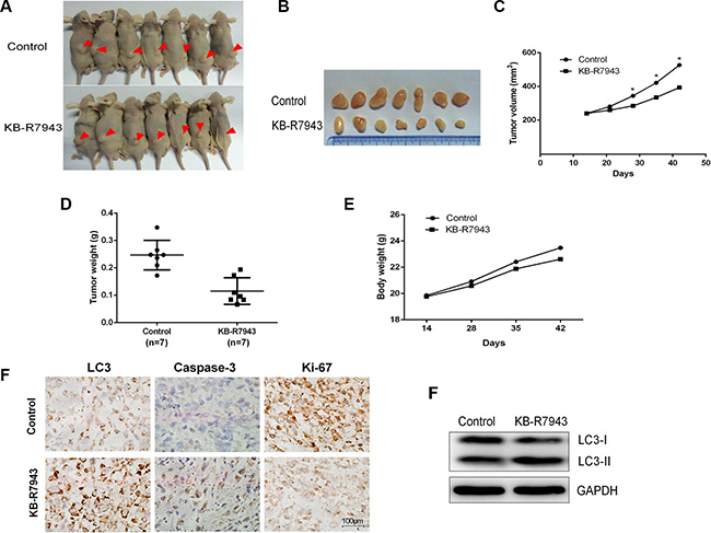KB-R7943 inhibited PC3 xenograft tumor growth in vivo.
