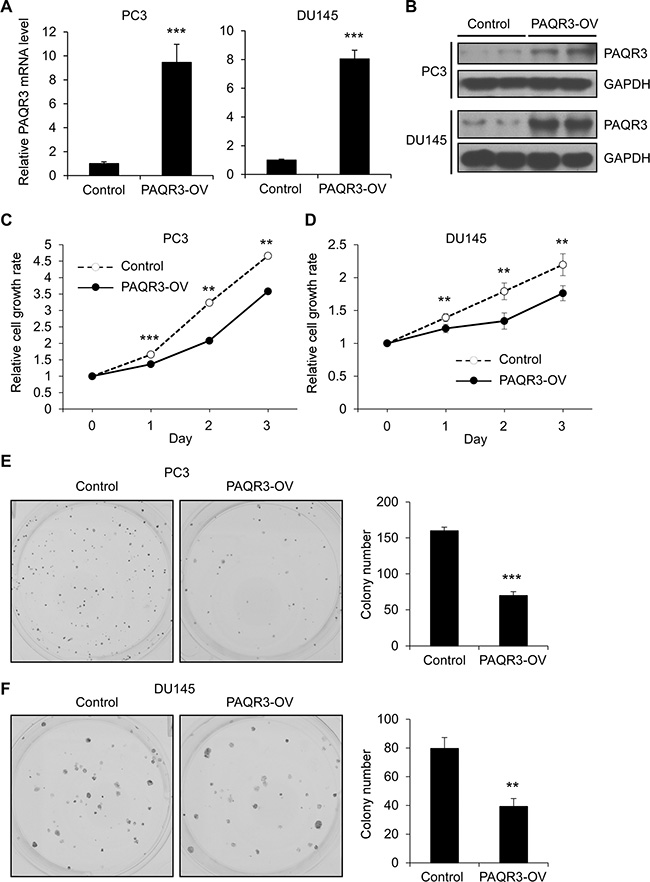 PAQR3 overexpression reduces cell proliferation and colony formation in human prostate cancer cells.