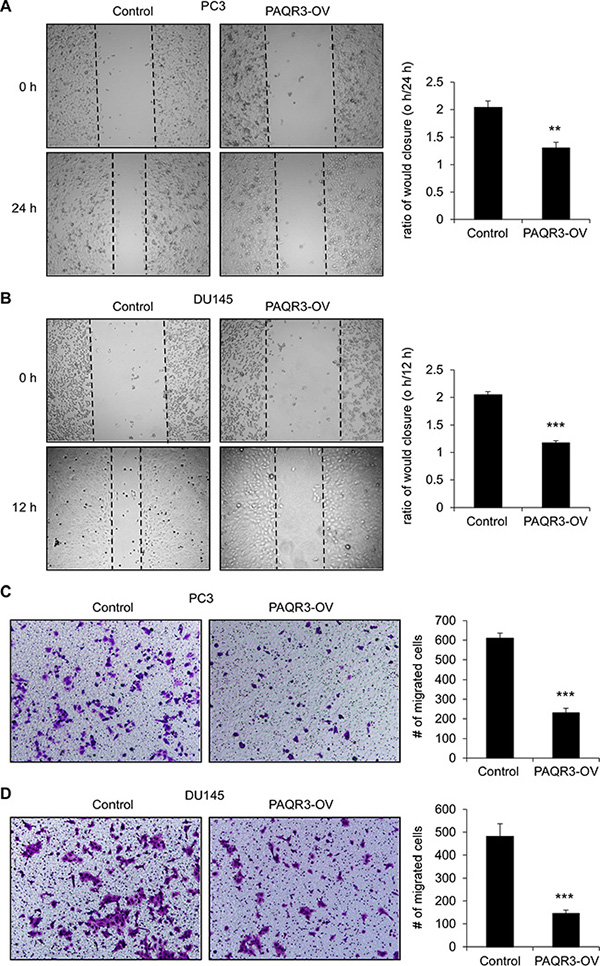 PAQR3 overexpression reduces migration of human prostate cancer cells.