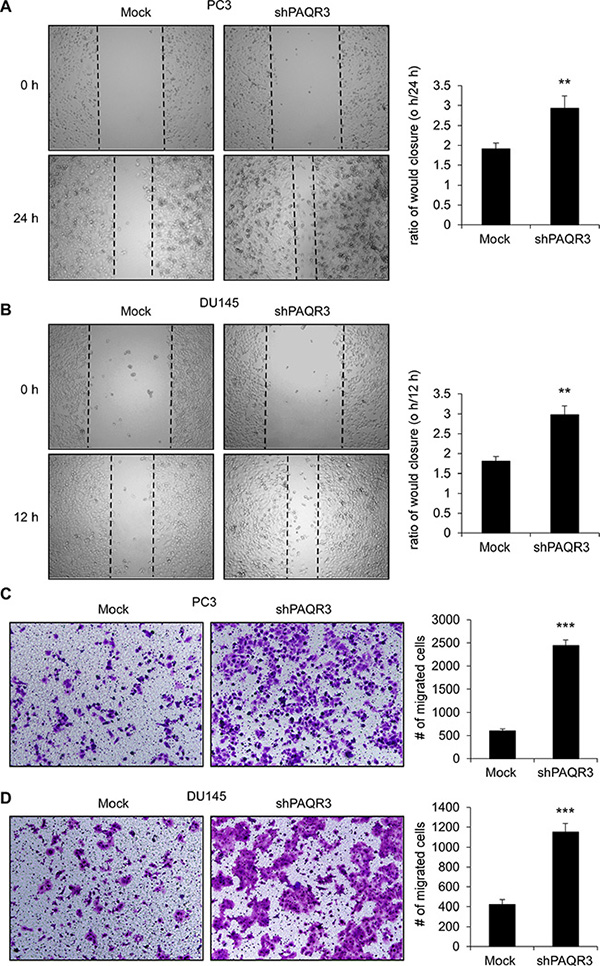 Knockdown of PAQR3 enhances migration in human prostate cancer cells.