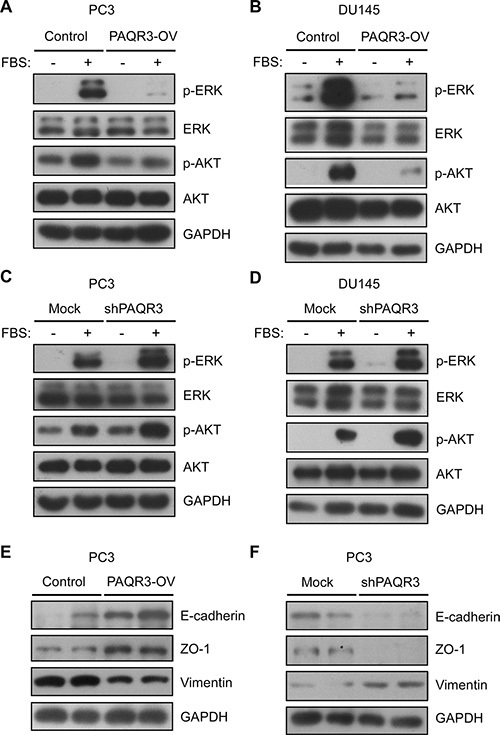 PAQR3 inhibits PI3K/AKT and MAPK/ERK signaling pathways and suppresses EMT features in human prostate cancer cells.