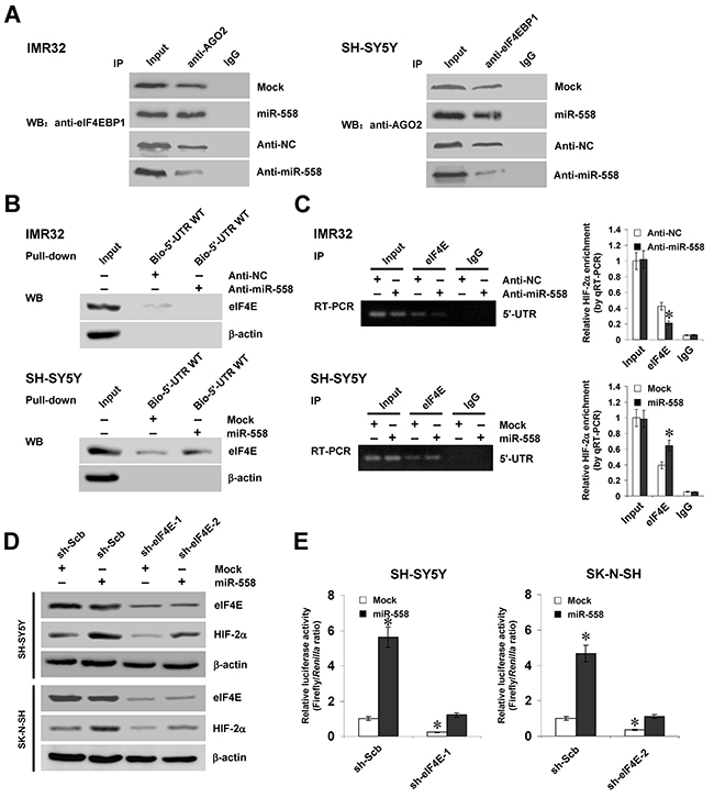 eIF4E contributes to miR-558-facilitated HIF-2&#x03B1; expression in NB cells.