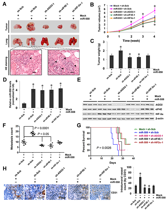 miR-558 promotes the growth, metastasis, and angiogenesis of NB cells through facilitating HIF-2&#x03B1; expression in vivo.