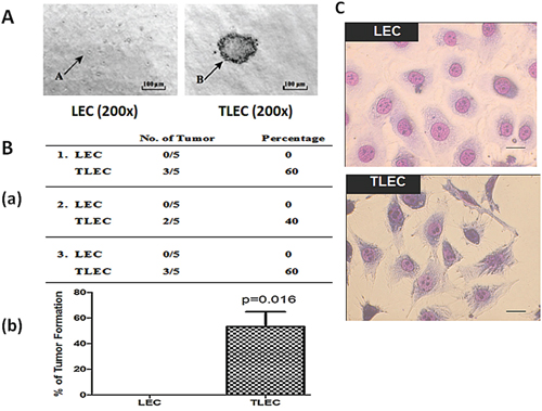 Morphology and tumorigenic properties of TLECs.