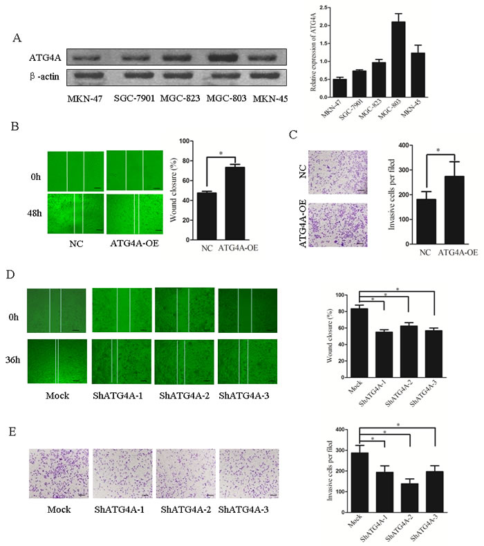 ATG4A promotes gastric cells migration and invasion