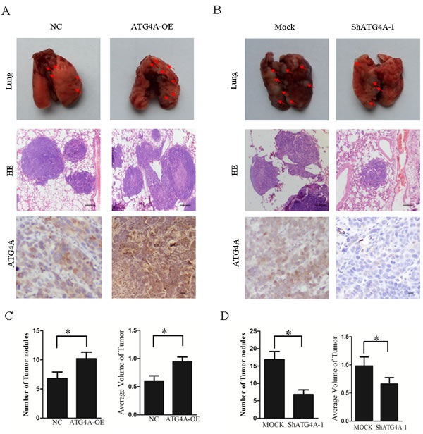 ATG4A promotes the lung metastasis of gastric cancer cells.