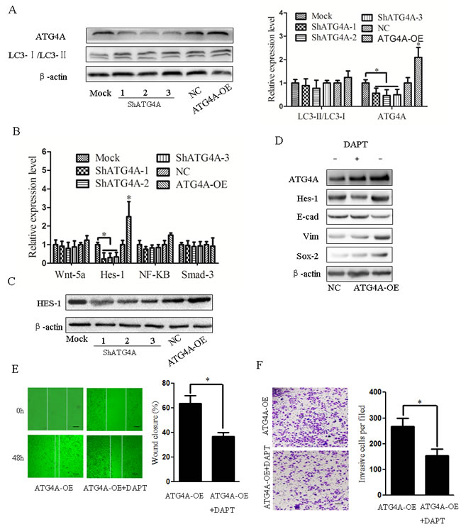 Notch signaling is involved in the ATG4A-induced EMT and stemness of gastric cancer cells.
