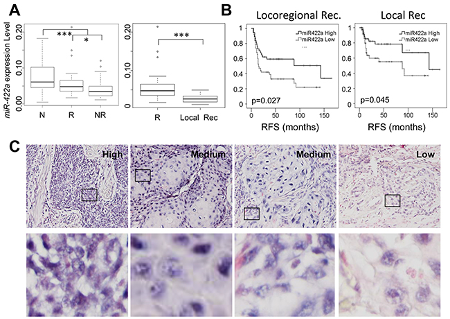 The level of expression of miR-422a is downregulated in oropharynx tumors from patients who have experienced early loco-regional recurrence.