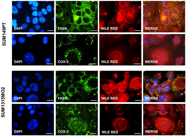 FASN and COX-2 co-exist in lipid bodies in breast cancer cells.