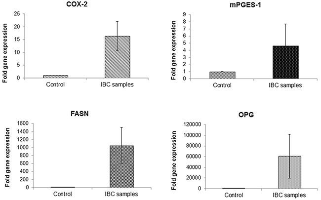 Upregulation of COX-2, mPGES-1, FASN and OPG expression in patient inflammatory breast cancer tissue.