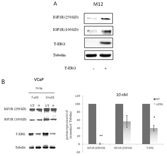 Effect of TMPRSS2-ERG on IGF1R protein and mRNA levels in prostate cancer cells.