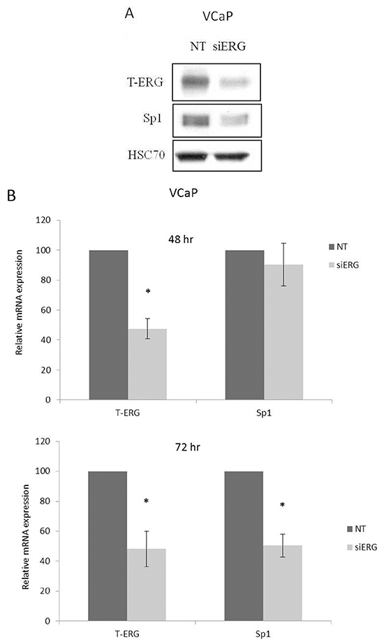 Effect of T-ERG expression on transcription factor Sp1.