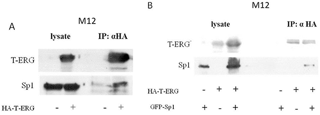 Co-immunoprecipitation assays of Sp1 and T-ERG.