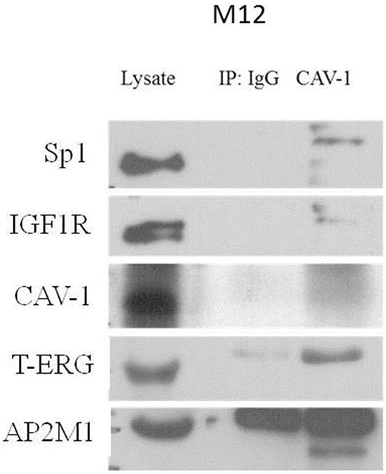 Co-immunoprecipitation assay of T-ERG with CAV1 and AP2M1.