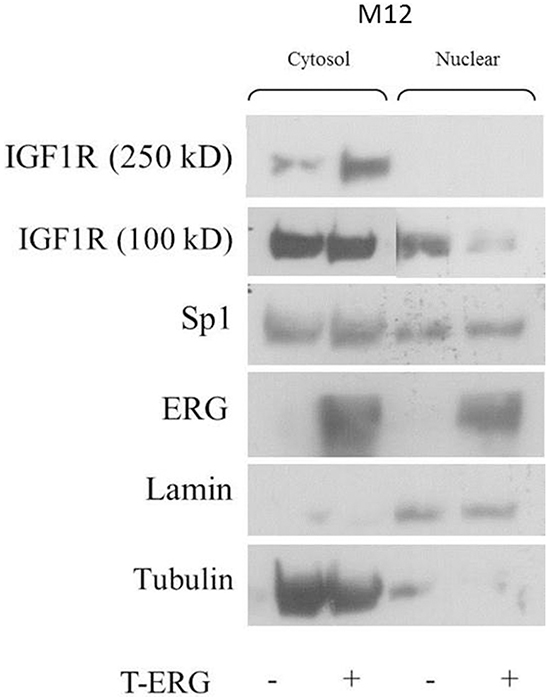 Effect of TMPRSS2-ERG on cellular localization of IGF1R.