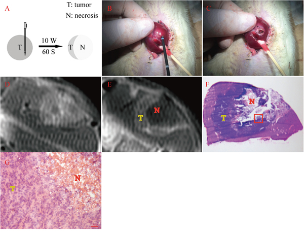 Residual tumor induced by MWA with its MRI and histopathology verification.