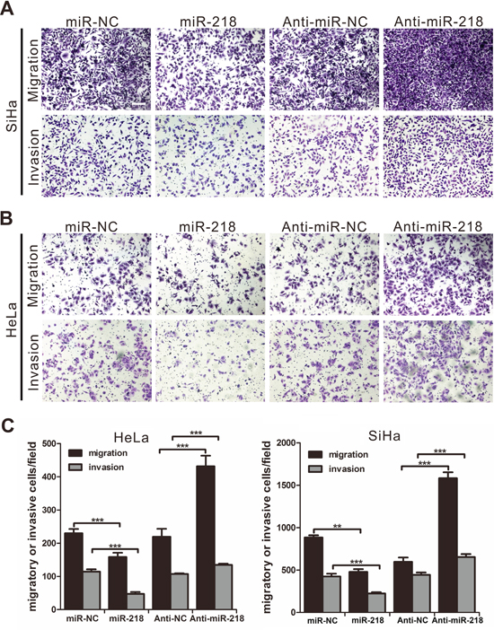 MiR-218 inhibits cervical cancer cell migration and invasiveness in vitro.