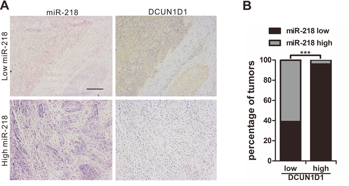 Clinical associations of miR-218 with DCUN1D1 expression.