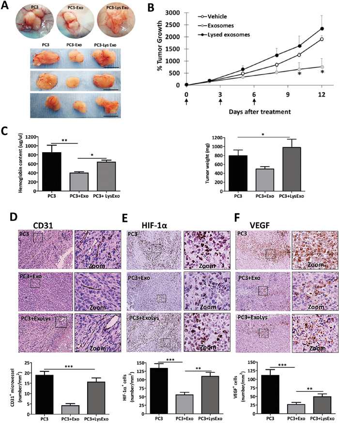 MenSCs-derived exosomes decrease angiogenesis and tumor growth in vivo.